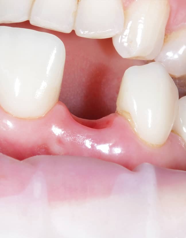 Treatment - Kensington Dental