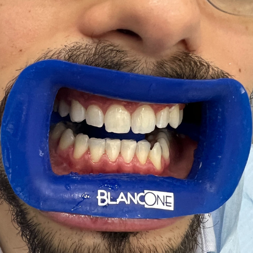 Smile Gallery - Kensington Dental Studio